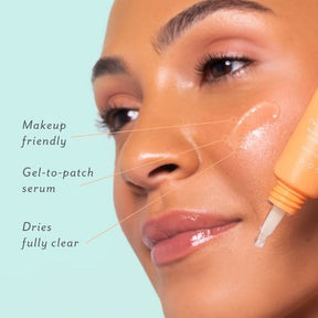 Patchology S.O.S. Totally Invisible Clarifying Liquid Patch