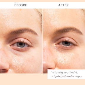 Patchology Skin Remedy Smoothing Eye Gels